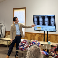 Donaldson showing Xray slides of the stages of osteoarthritis in the knees. Donaldson showing Xray slides of the stages of osteoarthritis in the knees.